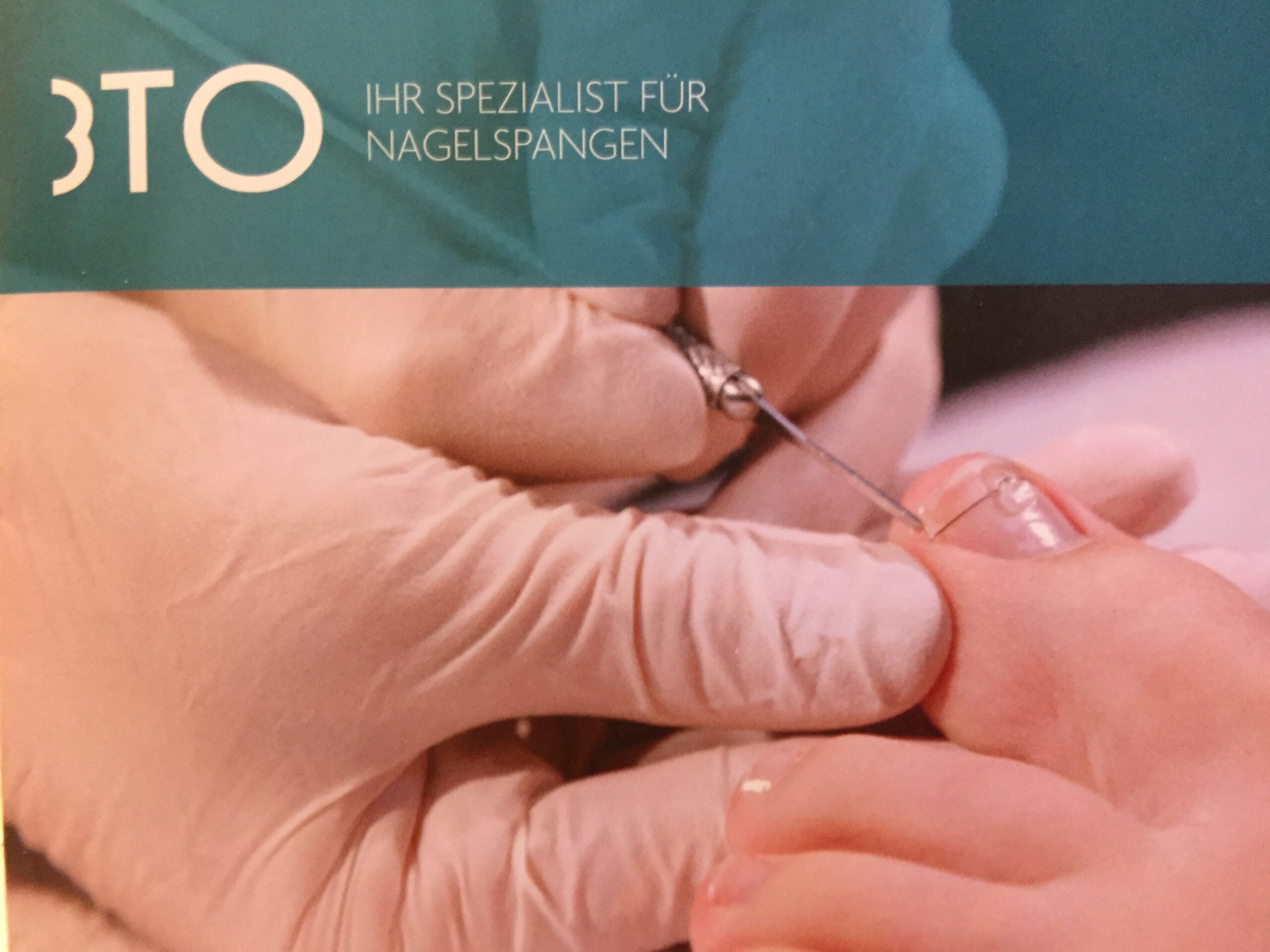 Nagelkoorekturspangen